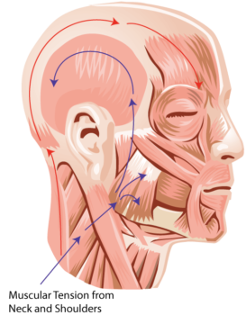 muscular tension in the neck and facial msucles can cause headaches and pain